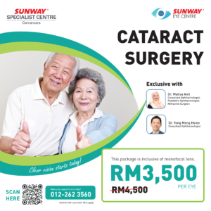 Cataract Surgery