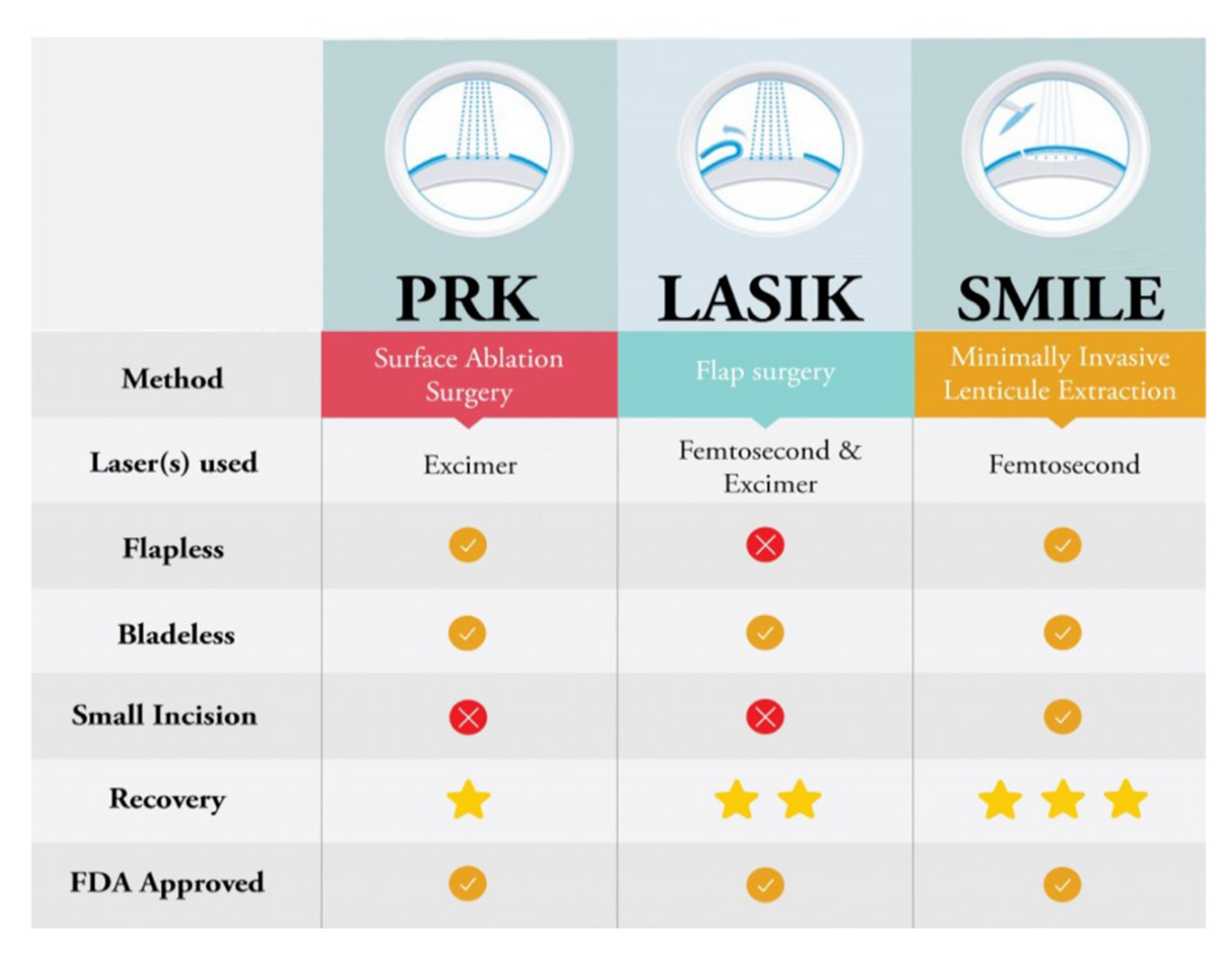 ICL (Implantable Collamer Lens)